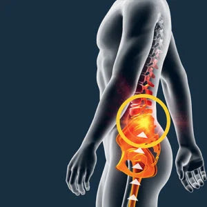 That Pain in Your Knees and Lower Back Could Be Linked to Your Feet and Poor Foot Support!