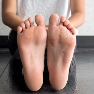 Tips To Manage Flat Feet