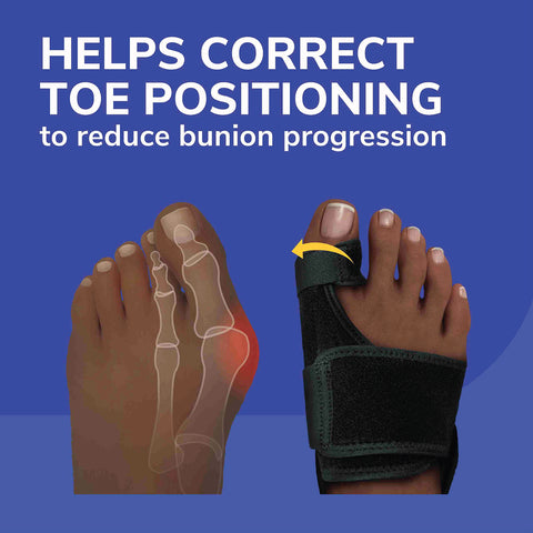 Bunion Relief & Toe Corrector - 1 Pair