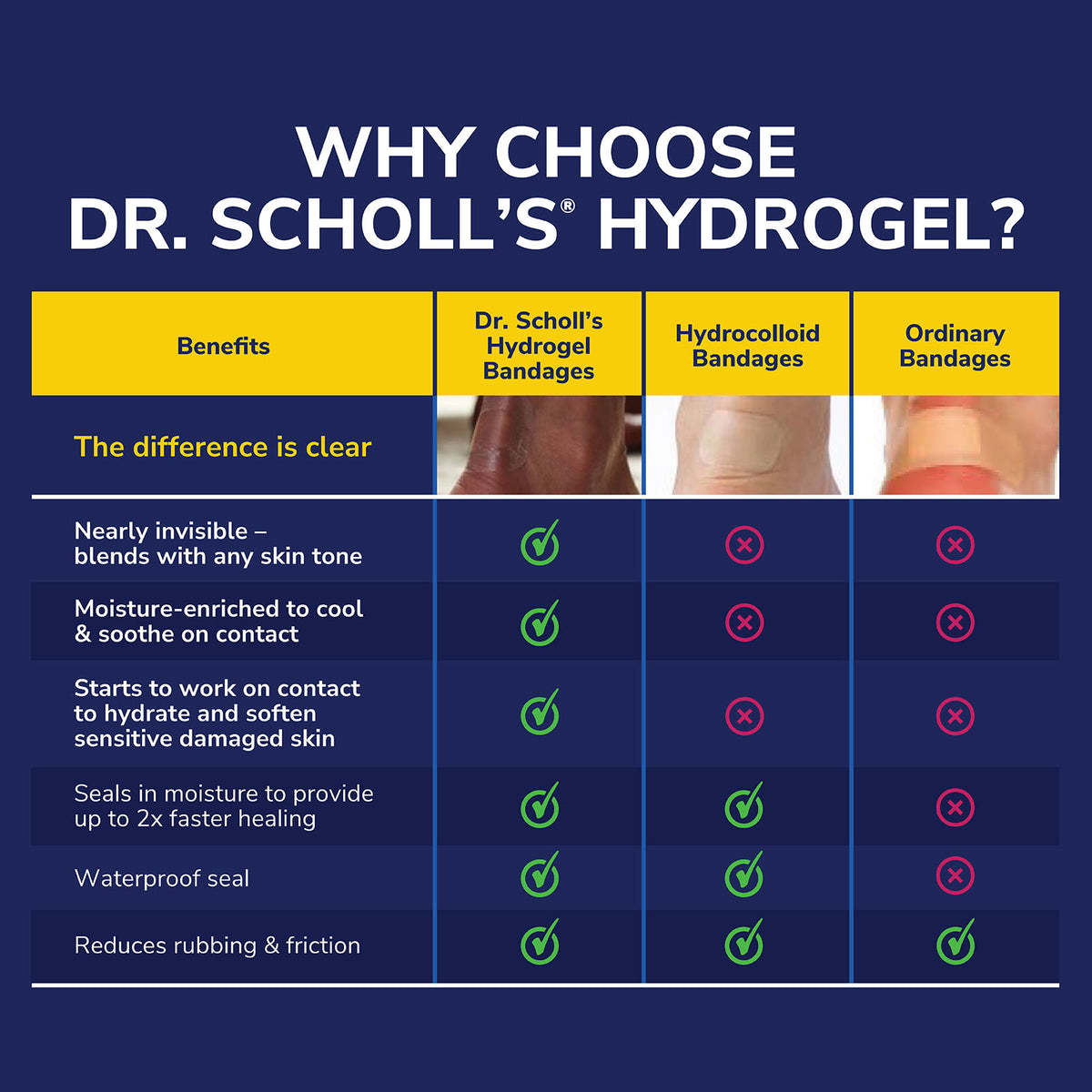 DuraGel Corn Remover | Dr Scholls Singapore – Dr. Scholl's Singapore