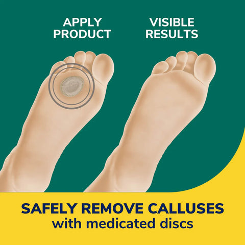 Callus Removers Seal & Heal Bandage with Hydrogel Technology 4ct
