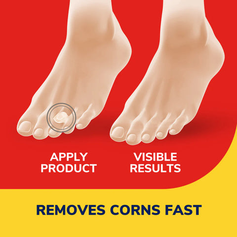Corn Removers 9 ct