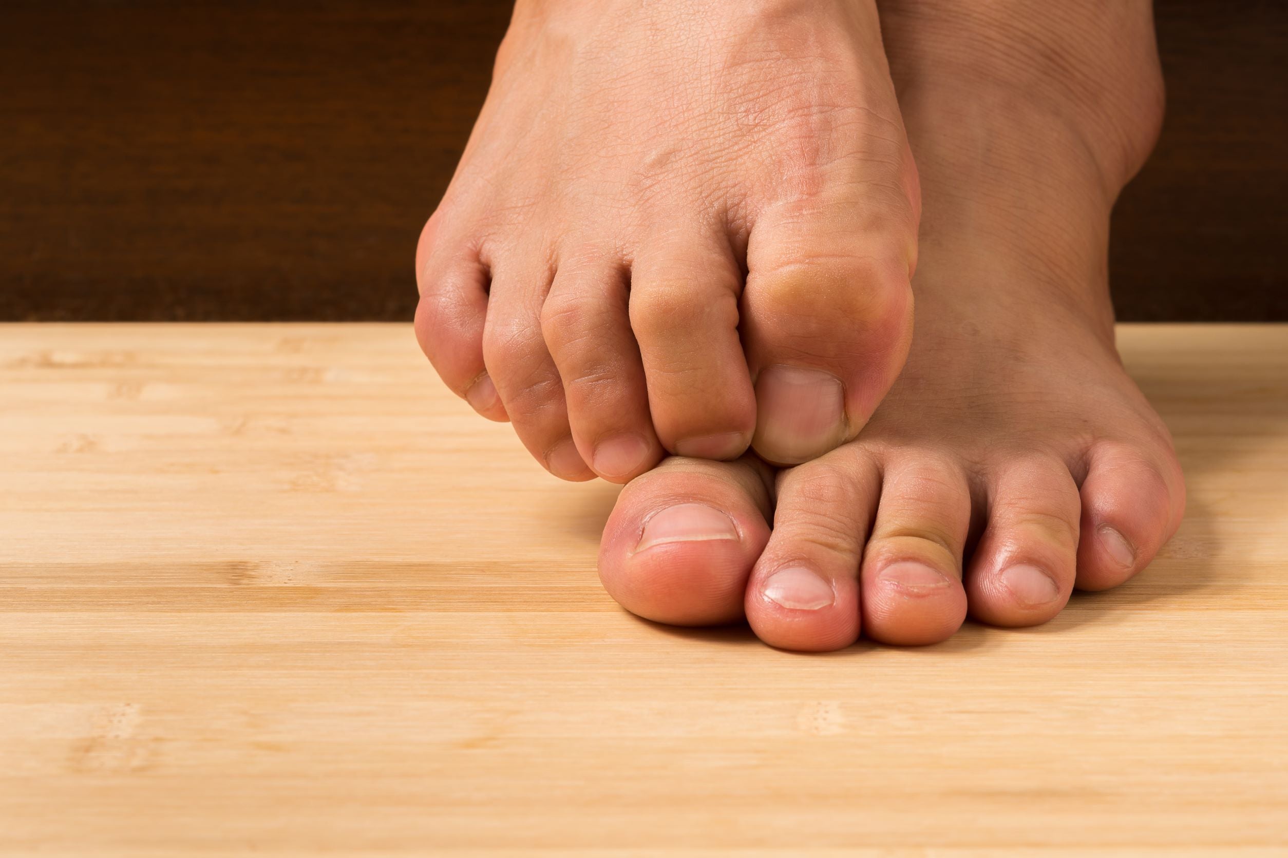 What Causes Itchy Feet? 4 Common Causes - JAWS podiatry
